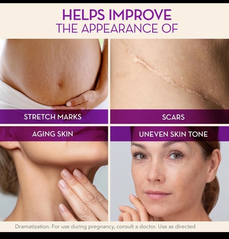 Cica Oil for Stretch Marks & Scars Visible Results in 4 Weeks Pre/Post Pregnancy